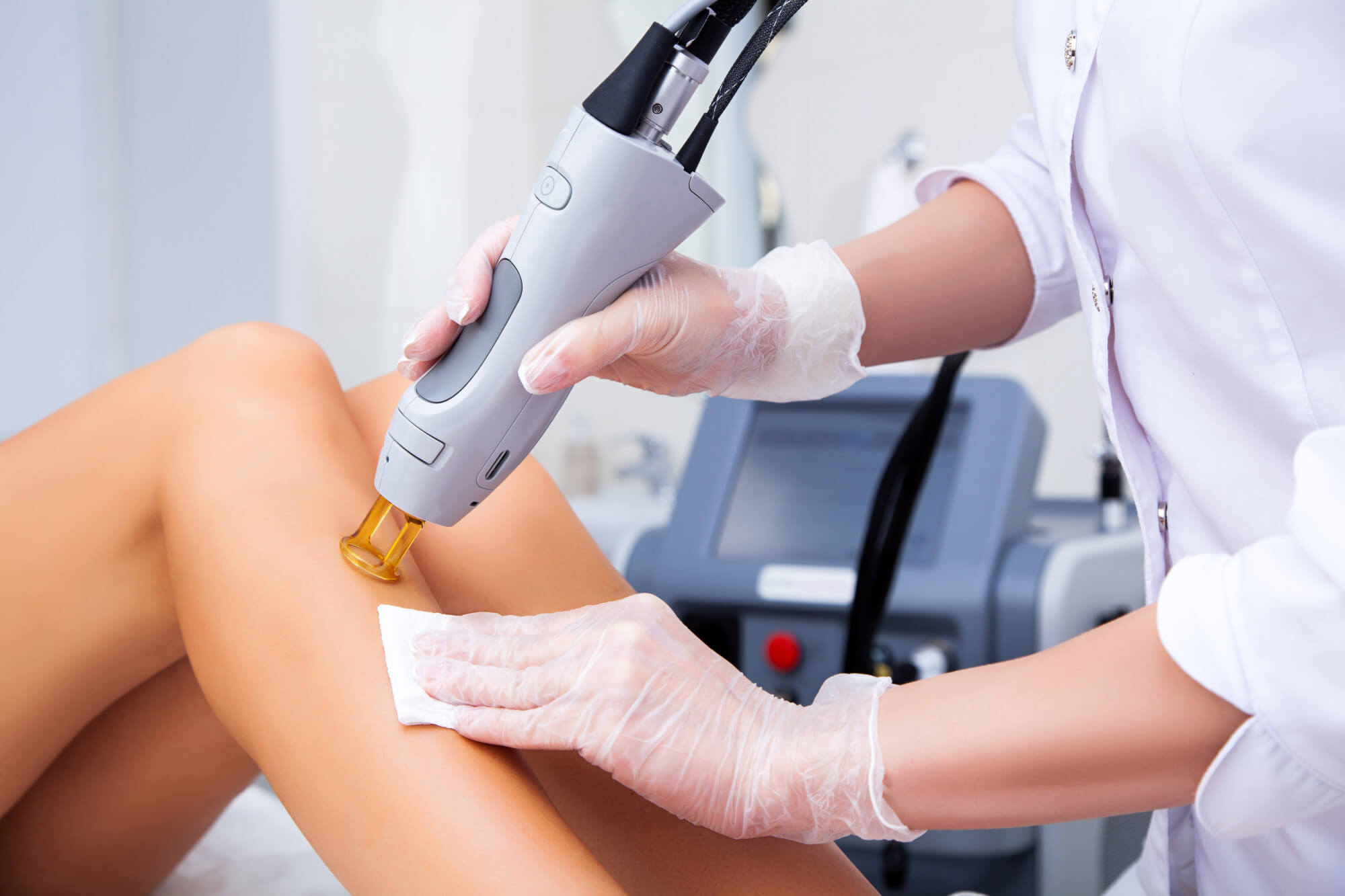 laser hair removal session